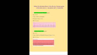 Relias Dysrhythmia Basic A Test Review Solution guide UPDATED 2023 A GRADED 100 VERIFIED [upl. by Lesser850]