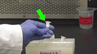 Triglyceride Determination [upl. by Arammat796]