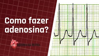 Como fazer adenosina na emergência para tratar taquicardia supraventricular paroxística [upl. by Breger85]