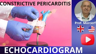 How to Escape the Grip of Constrictive Pericarditis Echocardiography Diagnose [upl. by Atter]