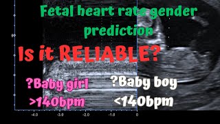 Ultrasound fetal heart rate gender prediction Is it reliable How accurate is it Three Cases [upl. by Akihsar]