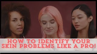 How to Identify Your Skin Problems A Complete Guide [upl. by Aivonas]