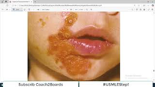 Chp41 Pharma Lippencott  Drugs used to treat Superficial Skin Infections [upl. by Miki]