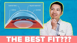 A MUST WATCH How to Get the Best Scleral Lens Fit [upl. by Ynnad]