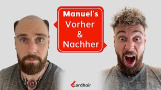 Manuels Transformation  Lordhair Haarsystem für Männer [upl. by Sisenej]