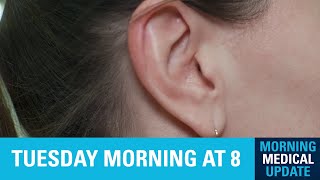 Morning Medical Update  Pulsatile Tinnitus [upl. by Frost]