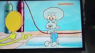 Squidward nose surgery [upl. by Irpac]