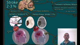 Stroke Ischemic Stroke vs TIA [upl. by Sela]