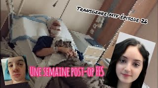 Transgenre mtf épisode 26 Une semaine post op FFS [upl. by Neurath]