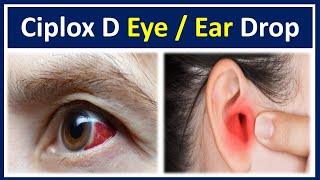 Ciplox d eye ear drops  Ciprofloxacin dexamethasone eye ear drops ciplox d  Ciplox d eye drops [upl. by Saffier]