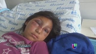 Niña brutalmente atacada en su escuela quedó con el rostro desfigurado  Primer Impacto [upl. by Maxma]