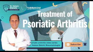 Treatment Of Psoriatic Arthritis Dr Hatem Eleishi [upl. by Audrit922]