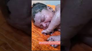 Newborn Received With Meconium Stained youtube youtubevideo viralvideobabydocter pediatrician [upl. by Hinze]