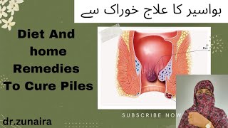 Management and treatment of piles  piles ka ilaj ghar ma  hemorrhoids [upl. by Galasyn]