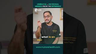 Umbilical vs incisional Hernia  Know the Difference  Mykare Health [upl. by Mcnully885]