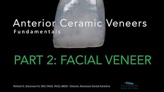 Anterior Ceramic Veneers Part 2 Facial Veneer [upl. by Karlen]