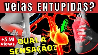 VEIA ENTUPIDA QUAL A SENSAÇÃO Como combater a falta de circulação nas pernas pés e coração [upl. by Nelubez704]