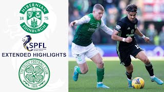 Hibernian vs Celtic Extended Highlights  SPFL  CBS Sports Golazo Europe [upl. by Ullund]