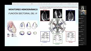 Seminario Imagen Cardiaca Monitoreo hemodinámico por ecocardiografia [upl. by Aicemaj]