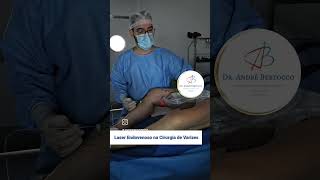 Laser Endovenoso na Cirurgia de Varizes varizes saude laser veias vasinhos skincare estetica [upl. by Fabian]