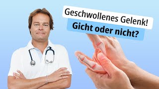 Geschwollenes Gelenk Gicht oder nicht [upl. by Gorden]