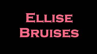 Ellise  Bruises InstrumentalKaraoke [upl. by Nerta]