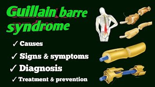 guillain barre syndrome [upl. by Horbal]