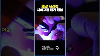 쾌감 지리는 치아교정 대리체험 [upl. by Squier]