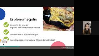 🎬 Aula Pocket Nº 02 Diagnóstico Diferencial das Doenças Transmitidas por Carrapatos em Cães [upl. by Philip]