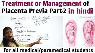 Management or treatment of Placenta Previa Part2  प्लेसेंटा प्रेविया में डिलीवरी नार्मल या ऑपरेशन [upl. by Valencia26]