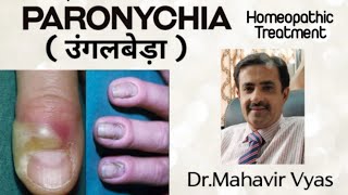 Paronychia  उंगलबेड़ा  Homeopathic Treatment  DrMahavir Vyas [upl. by Camm49]