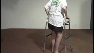 Abnormal Gait Exam  Neuropathic Gait [upl. by Terej]