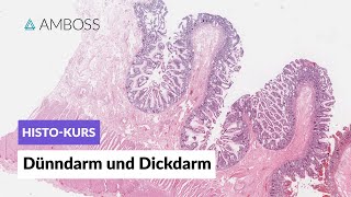 Histologie Dünndarm und Dickdarm  Mikroskopische Anatomie  AMBOSS Video [upl. by Yeorgi]