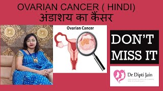 OVARIAN CANCER  HINDI अंडाशय का कैंसर DONT MISS IT [upl. by Colwell]