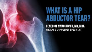 What is a Hip Abductor Tear  Trochanteric Pain Syndrome Treatment  Manhattan New York Brooklyn [upl. by Joelly862]