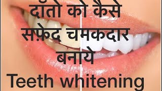 home remedies to clean yellow teeth  दांतों का पीलापनYellow Teethदूर कैसे करे how to clean teeth [upl. by Leirraj]