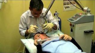 Dr Bruce Williamson CO2 Laser Demonstration to Slow Aging for Skin [upl. by Lavella]