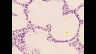 Simple squamous epithelium Lung [upl. by Anilet]