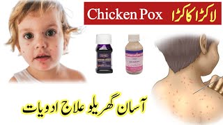 Chickenpox treatment Chickenpox medicine Chickenpox ke nishan chickenpoxkikharish akralakra [upl. by Ellga]