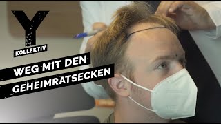 Haartransplantation in der Türkei  Schönheitsoperationen bei Männern  YKollektiv [upl. by Dalia]