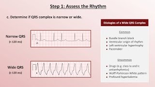 Intro to EKG Interpretation  A Systematic Approach [upl. by Blaine]