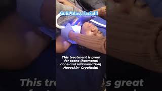 Feel the chill with this CRYOFACIALbeauty facial cryotherapy ice coldtherapy [upl. by Accebor]