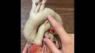 Ligamentum Arteriosum [upl. by Mungam34]