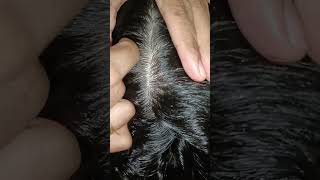 ASMR Hair for sleepingnitpicking hair [upl. by Hammad]