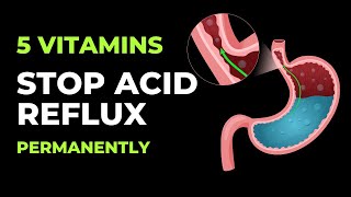 Top 5 Vitamins To Stop Acid Reflux Permanently  Acid Reflux  INTAI [upl. by Gnouhp]