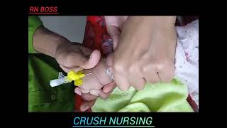 iv catheter inserted by Nurse with 24g cannula rnboss [upl. by Alcott232]