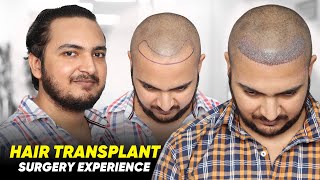 Hair Transplant in Muzaffarnagar  Best Results amp Cost of Hair Transplant in Muzaffarnagar [upl. by Sammons408]