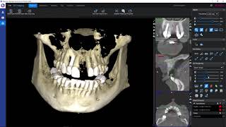 Korzystanie z przeglądarki Planmeca Romexis Viewer [upl. by Lletniuq387]