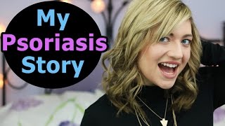 MY PSORIASIS STORY  Psoriasis Treatment Psoriasis Diet Positive Affirmations  Guttate Psoriasis [upl. by Ahsoj697]