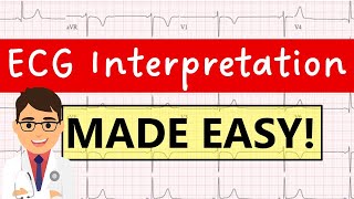 How to interpret an ECG systematically  EXPLAINED CLEARLY [upl. by Zuckerman132]